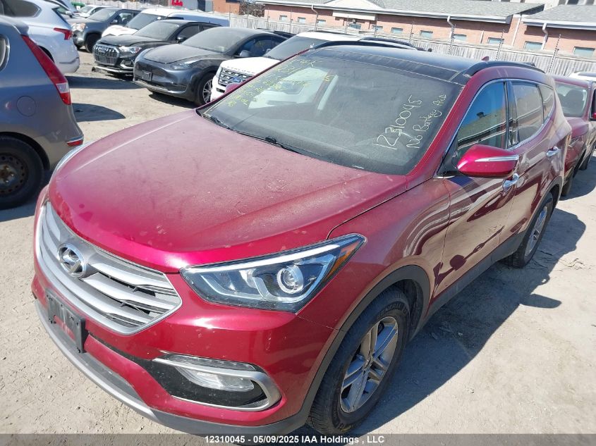 HYUNDAI SANTA FE 2017 VIN 5XYZUDLB6HG483967 фото 6